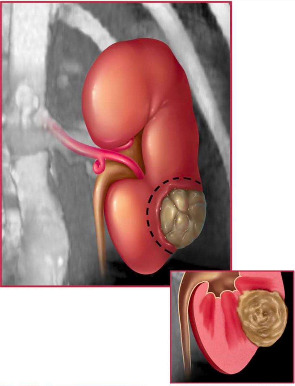 best urologist in indore