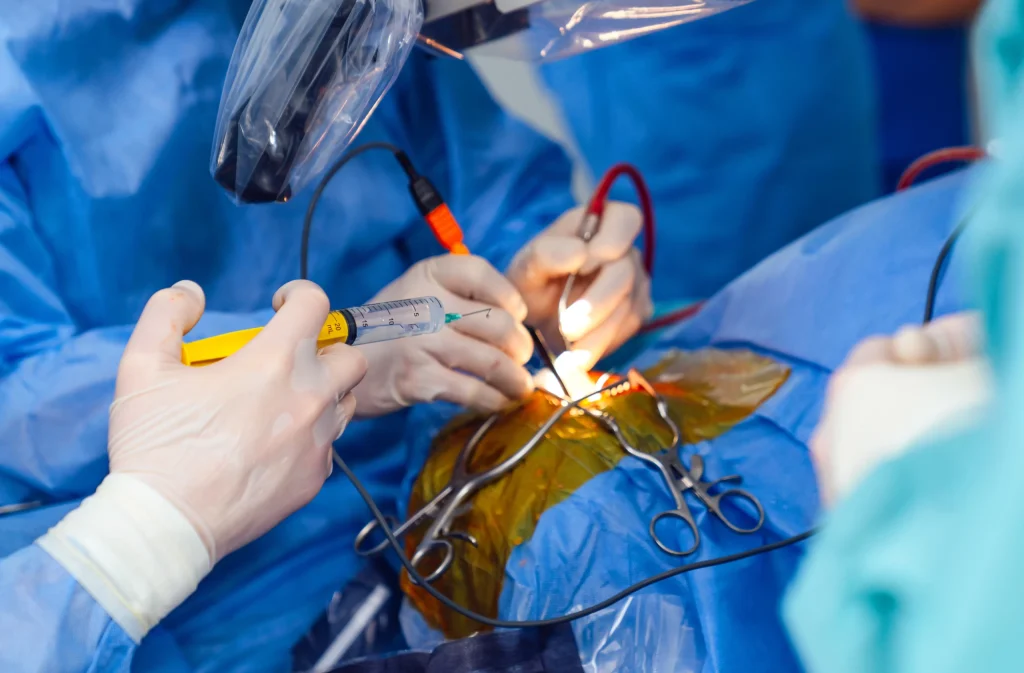 Laser Kidney Stone Surgery