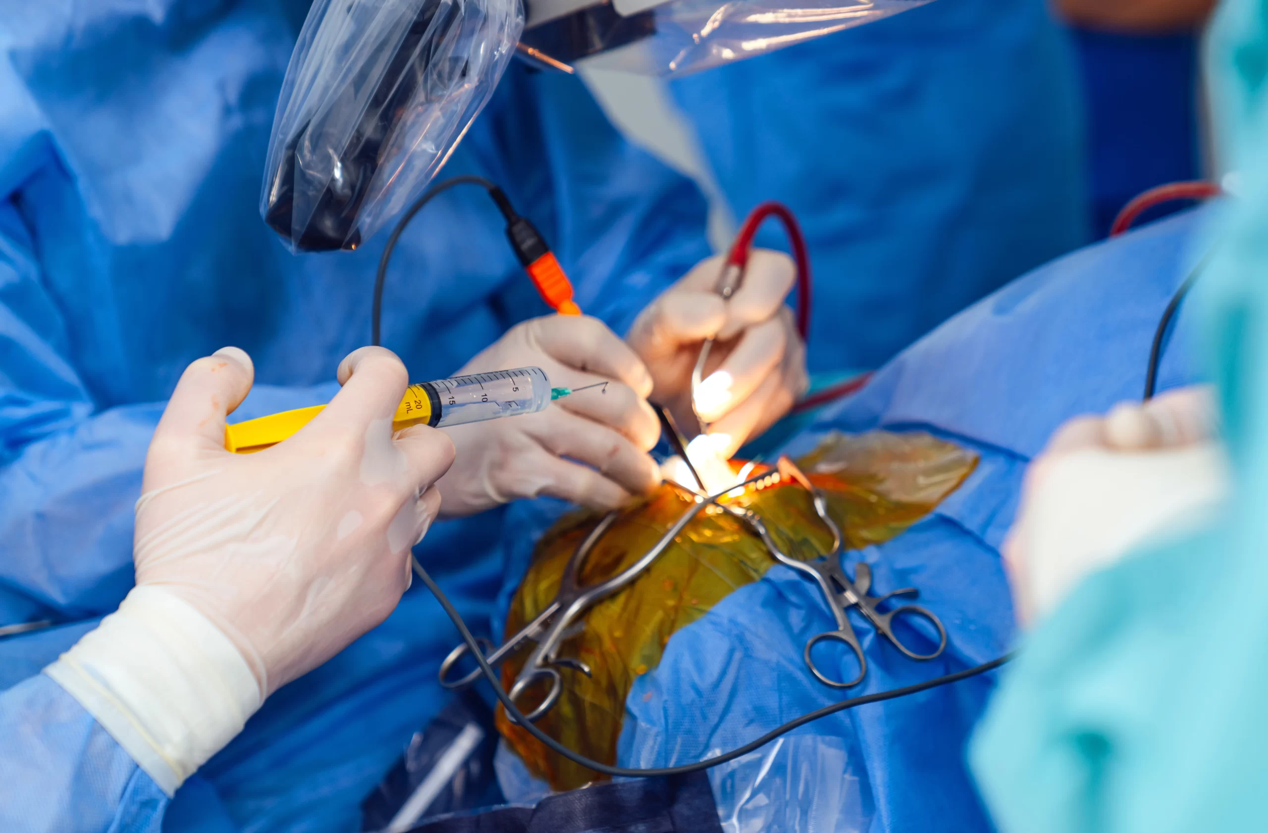 Laser Kidney Stone Surgery