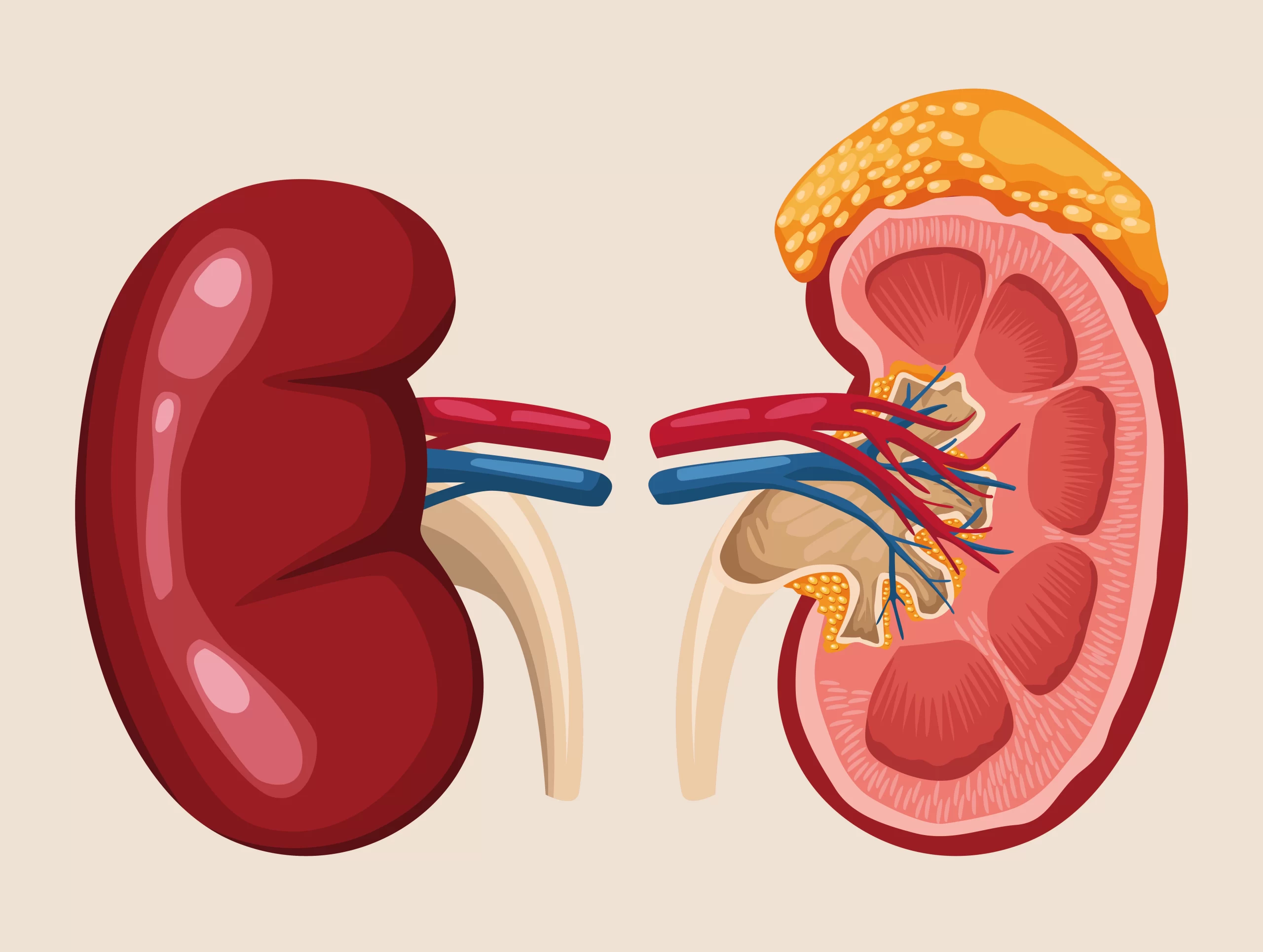 Kidney Disease
