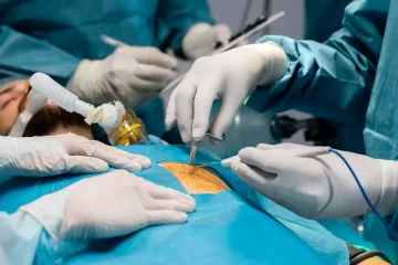 Kidney Stone Surgery