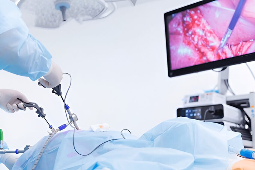 treatment-laparoscopic-kidney