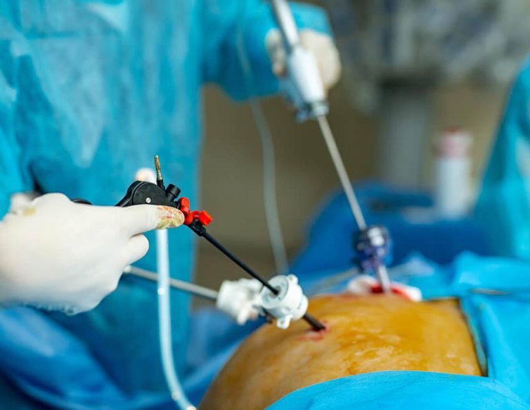 Endourology - Dr Yusuf Saifee