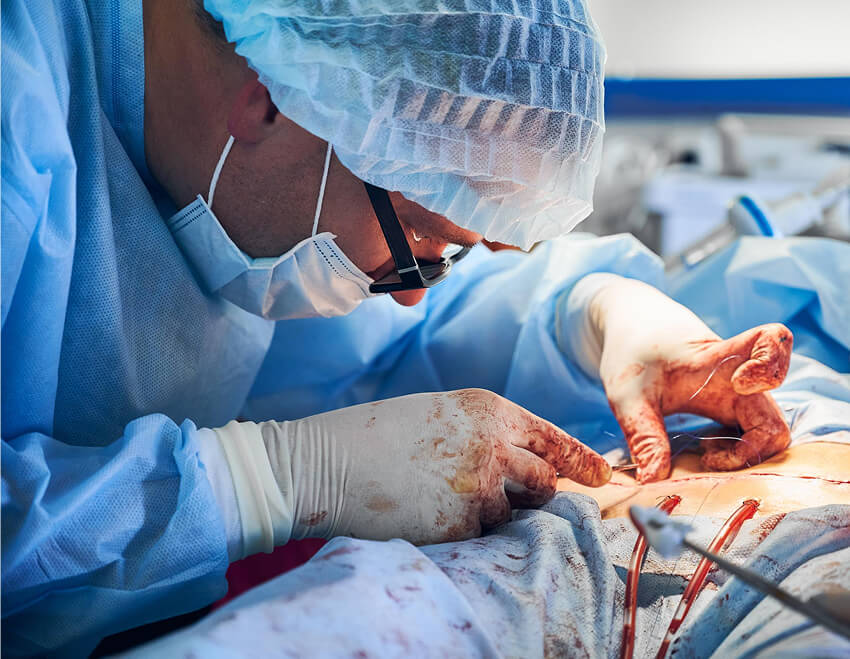 kidney-cancer-surgery-header