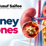 Kidney Stones