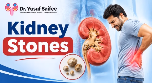 Kidney Stones