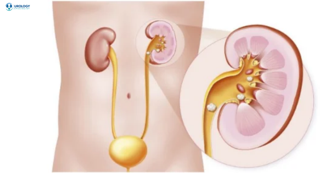 Best Urologist in Mumbai
