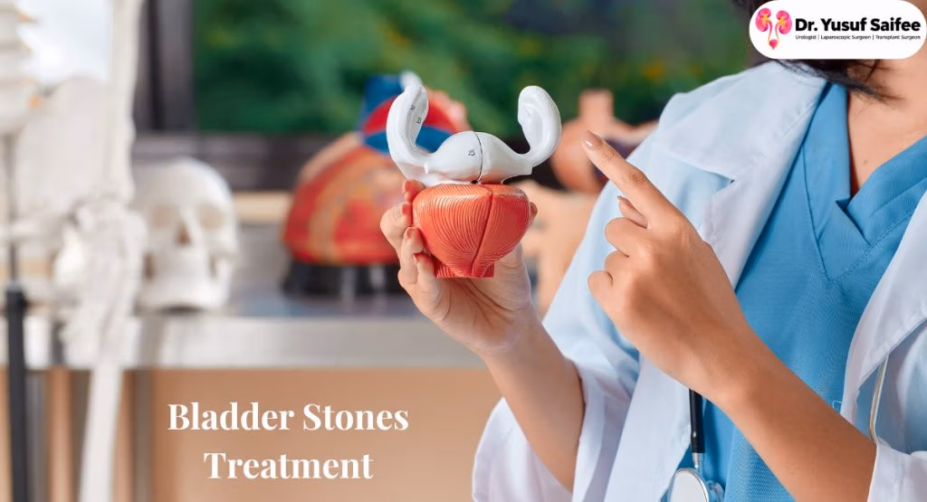 Bladder Stones: Dr Yusuf Saifee