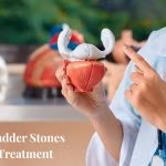 Bladder Stones: Dr Yusuf Saifee