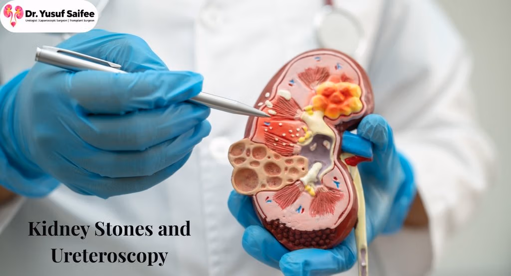 Kidney Stones: Dr Yusuf Saifee