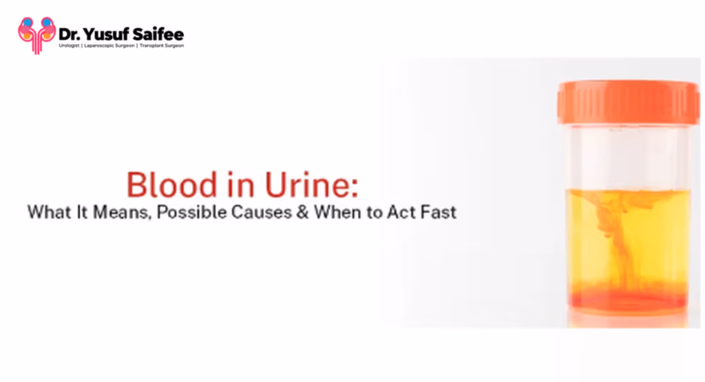 Best urologist in Mumbai