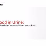 Best urologist in Mumbai