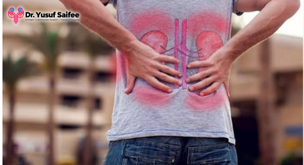 Best urologist in Mumbai