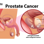 Best Urologist in Mumbai