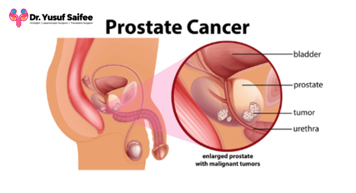 Best Urologist in Mumbai